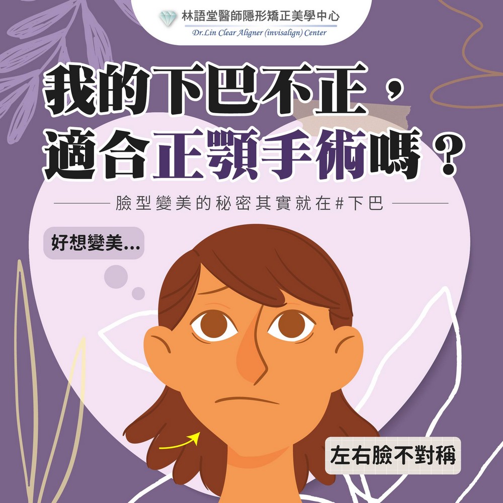 正顎手術是什麼？ 誰適合正顎手術？